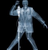 The Art of X-Ray Photography at Eden Roc